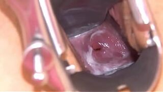 Gyno toys in her deep pussy cunt - porn video